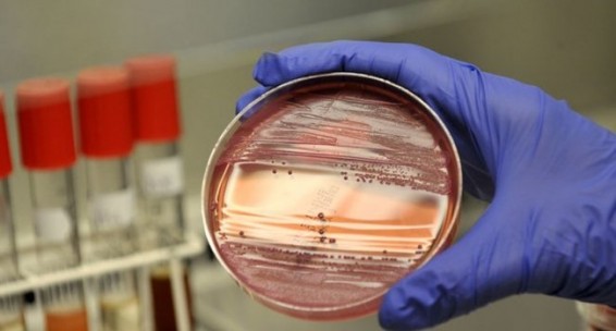 Հայաստանում 2017 թ սեպտեմբերին արձանագրվել է բրուցելոզի 22 դեպք