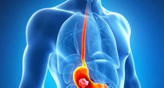 5 քայլ ստամոքսի առողջությունը պահպանելու ուղղությամբ