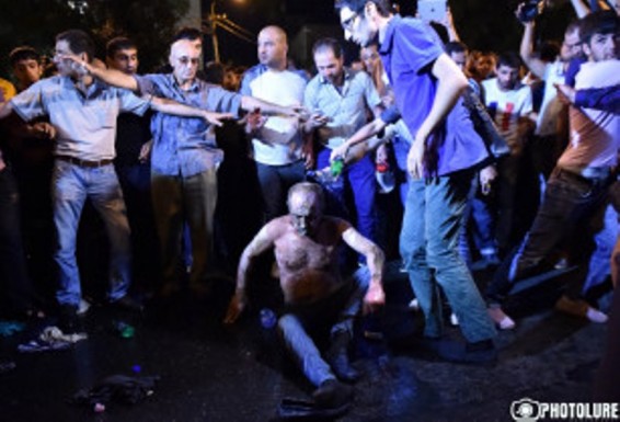 Ինքնահրկիզված քաղաքացին շոկից դուրս է եկել, հայտնի չէ՝ կյանքը չհաջողվի՞ փրկել, թե՞ ոչ