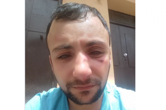 Վարդան Հարությունյանի հետ կապված միջադեպի մասնակիցներից մեկը բերման է ենթարկվել ոստիկանություն