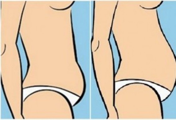 5 տեսակի «կանացի փորիկ» և պարզ միջոցներ, որոնք կօգնեն ազատվել ավելորդ սանտիմետրերից