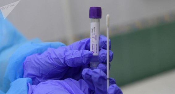 Плюс 485: число выявленных случаев COVID-19 в Армении выросло до 126709