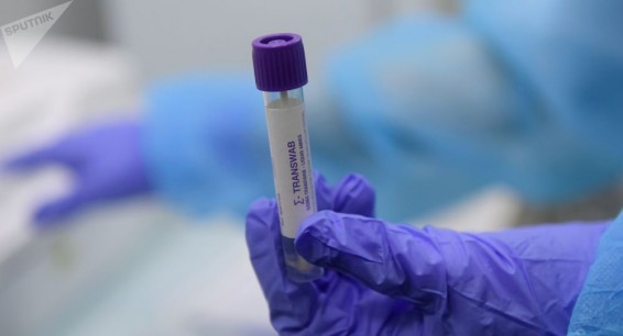 Плюс 843: число выявленных случаев COVID-19 в Армении выросло до 135967