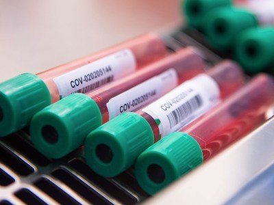 В Армении за сутки зарегистрировано 143 новых случая заражения коронавирусом
