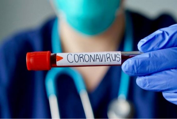В Арцахе в 48 тестах на COVID-19 вирус не обнаружен