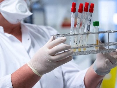 Коронавирус в Армении: 24 новые смерти
