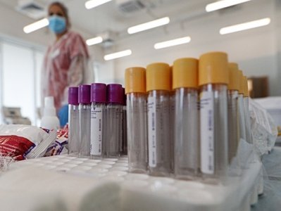 Коронавирус в Армении: 17 новых смертей