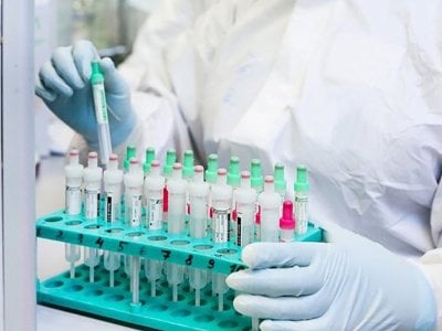 В Армении за сутки зарегистрирован 221 новый случай заражения коронавирусом