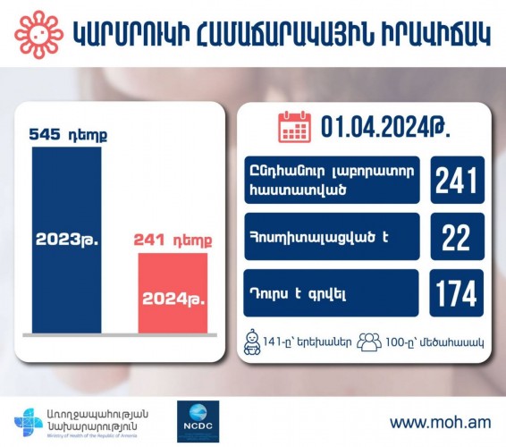 2024-ին Հայաստանում կարմրուկի 241 դեպք է գրանցվել