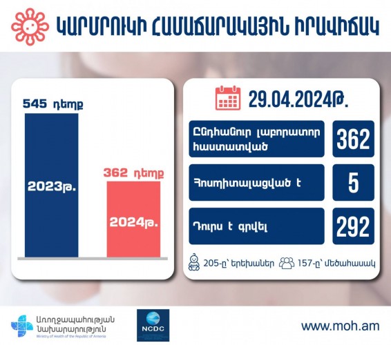 Ապրիլի 29-ի դրությամբ հաստատվել է կարմրուկով վարակման 362 դեպք