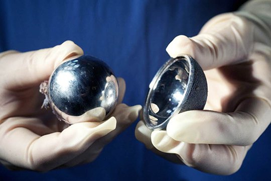 Johnson & Johnson-ը 1 միլիարդ դոլար կվճարի անորակ պրոթեզների համար