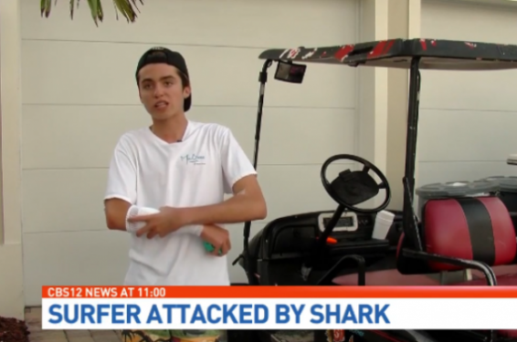 ԱՄՆ-ում շնաձուկը կծել է գիշատիչ ձկներից պաշտպանող սարք կրող դպրոցականին