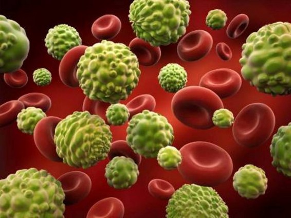 10 կողմնակի «ազդանշան», որոնք կարող են քաղցկեղի առկայության նշան լինել