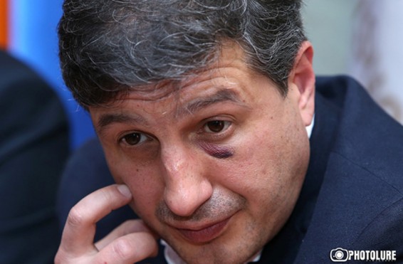 Ինչու է Սիմոն Բաբայանը «այցելել» Տիգրան Աթանեսյանին